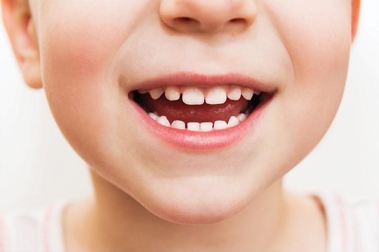 Çocuklarda diş gıcırdatma nedenleri ve tedavisi