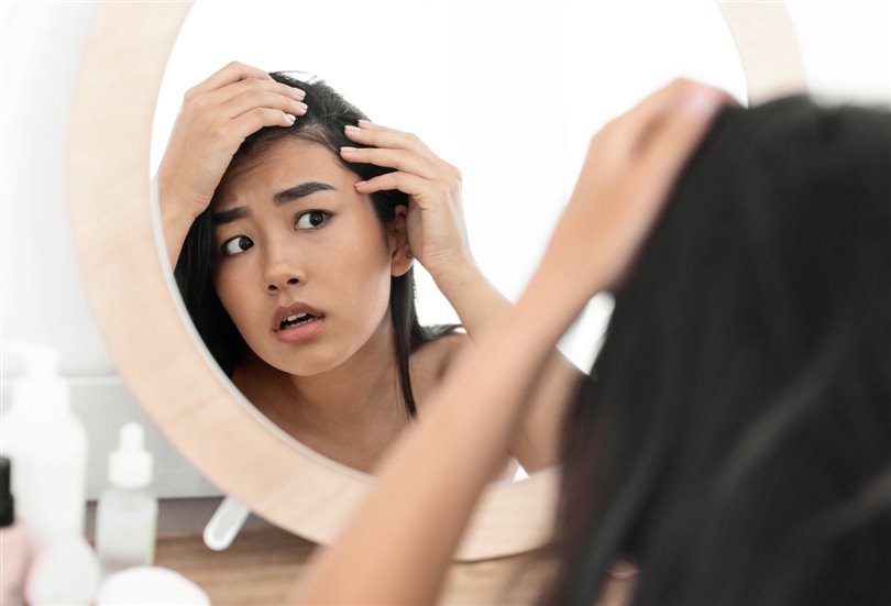Terim de bus | 9 facteurs importants qui provoquent la chute des cheveux